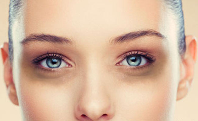 Causes and treatment for dark circle under eyes