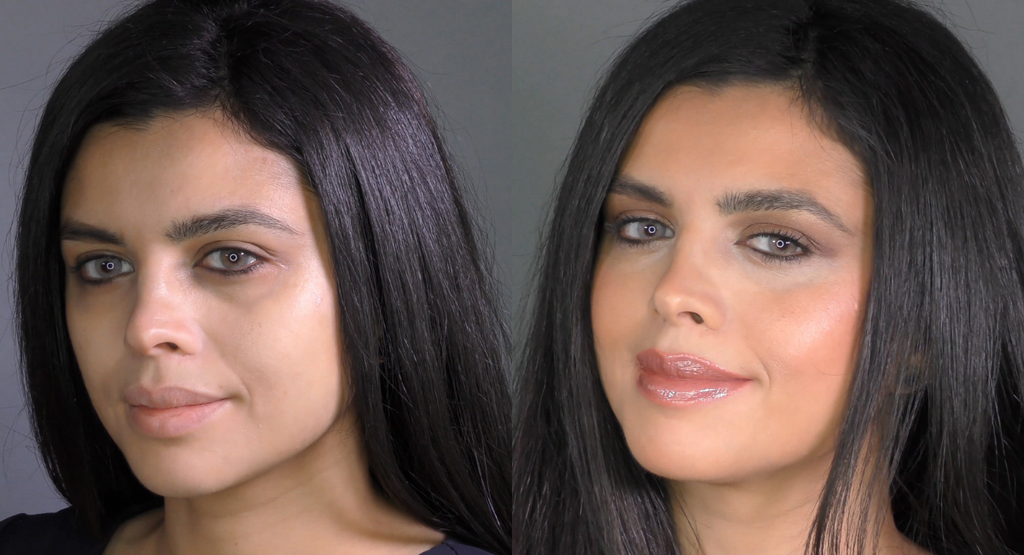 How to get rid of Dark Circles under the eyes
