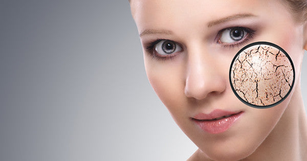 Managing Your Dry Skin